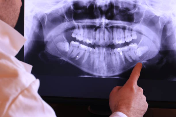 Best Emergency Tooth Extraction in Villa Rica, GA