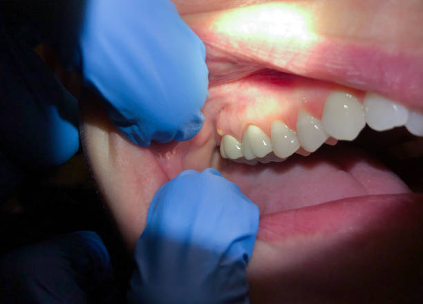 Best Emergency TMJ Treatment in Villa Rica, GA